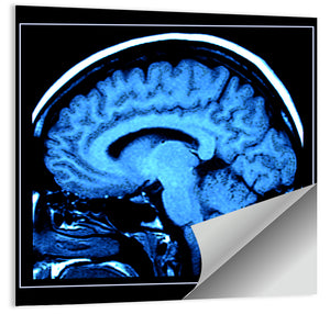 Human Brain MRI Wall Art