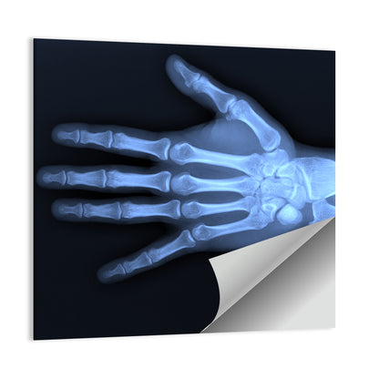 Hand X-Ray Wall Art