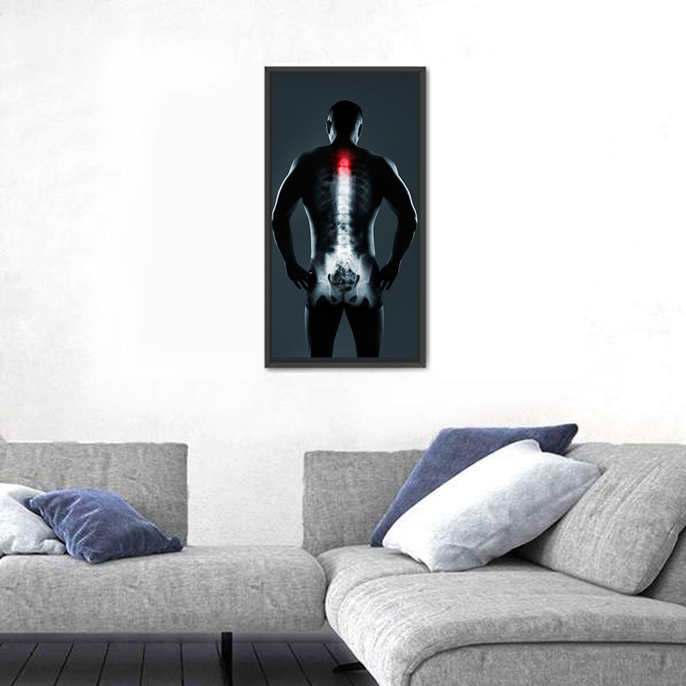 Human Spine X-ray Wall Art in a room, portrait