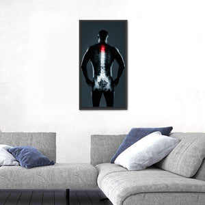 Human Spine X-Ray Wall Art