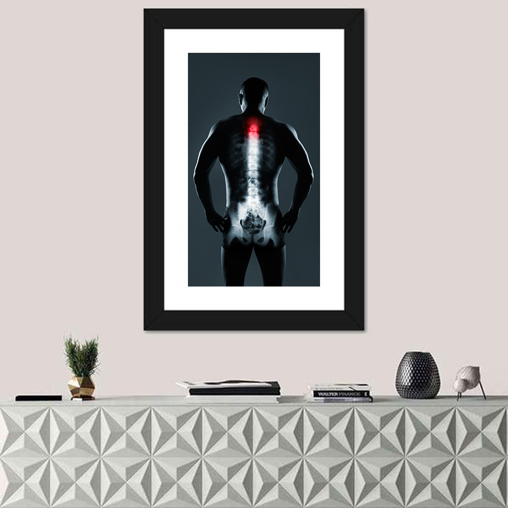 Human Spine X-ray Wall Art in a room, portrait