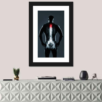 Human Spine X-Ray Wall Art
