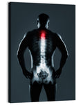 Human Spine X-ray Wall Art