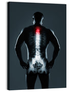 Human Spine X-ray Wall Art