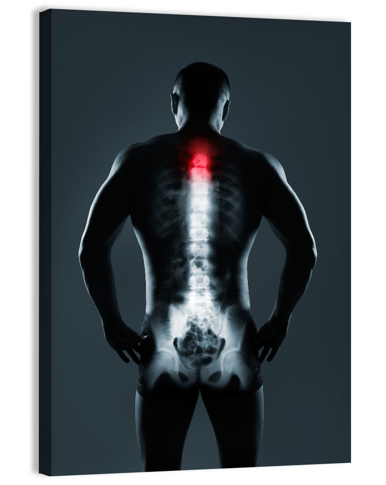 Human Spine X-Ray Wall Art