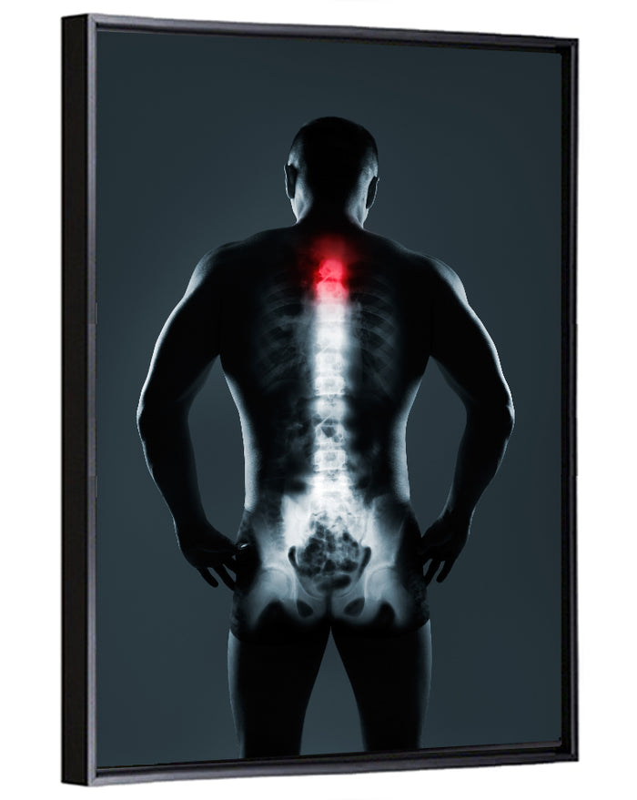 Human Spine X-ray Wall Art as a framed canvas